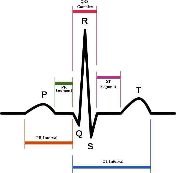 ECG waveform and feature of P to U